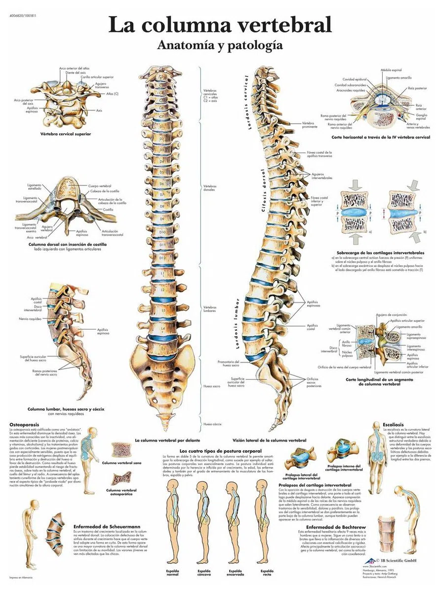 3B Scientific VR3152UU Impreso En Papel, la Columna Vertebral, Anatomía y Patología